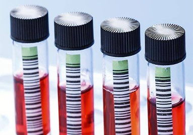 生物制品冷庫安裝的制冷設(shè)備造價是多少